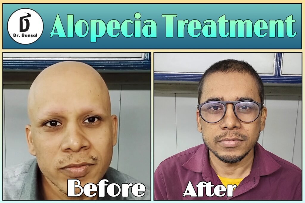 Best Doctor For Alopecia