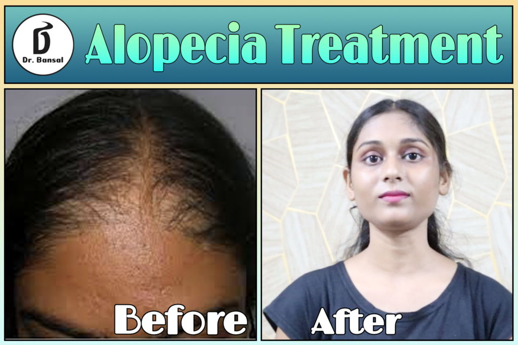 Why Is My Hair Falling out?