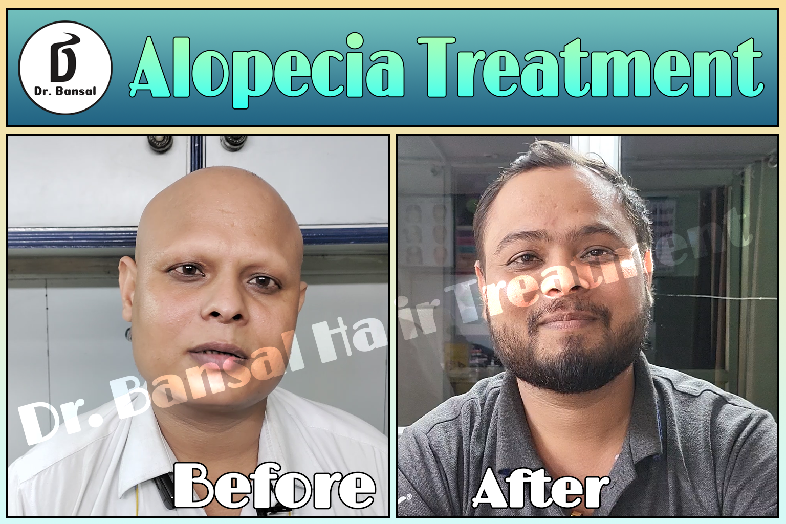 Hair Loss Treatment