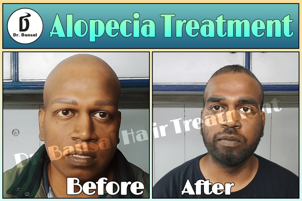 Expert advice on hair loss