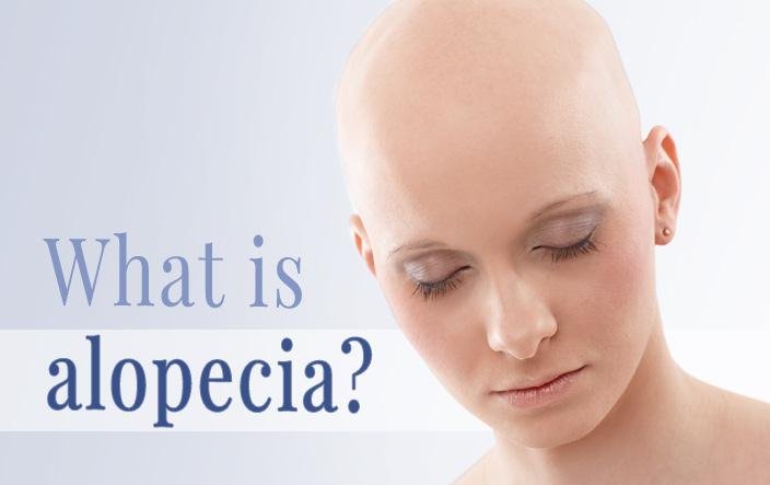 Alopecia Treatments