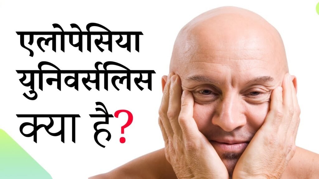 Alopecia Universalis Treatment In Ghaziabad