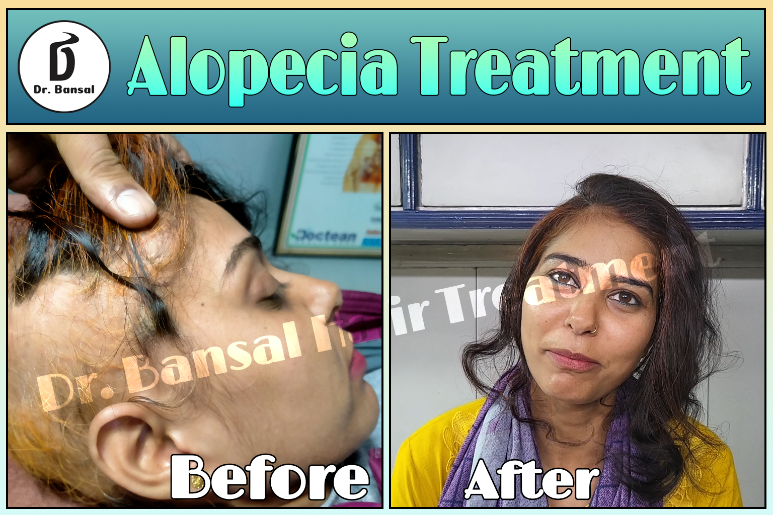 Top Alopecia Doctors in India