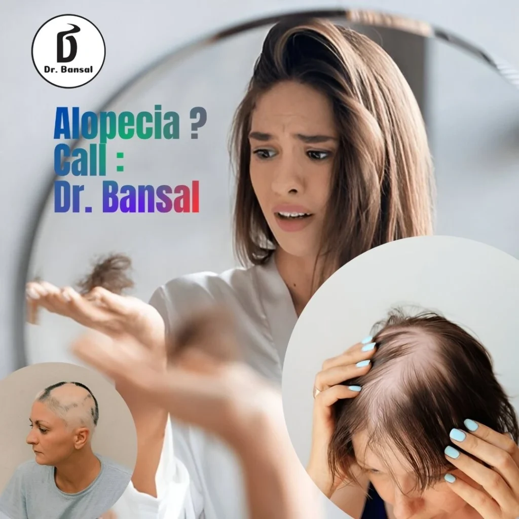 Treating Female Pattern Hair Loss-Dr Bansal-1