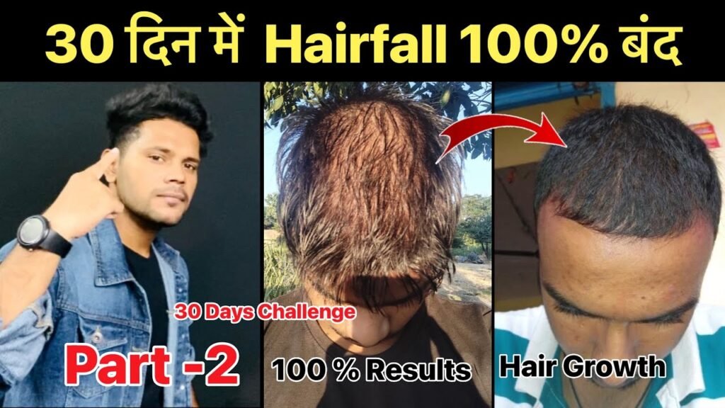 Stop hair fall In Ghaziabad