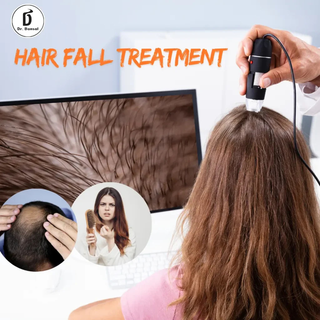 hair fall treatment