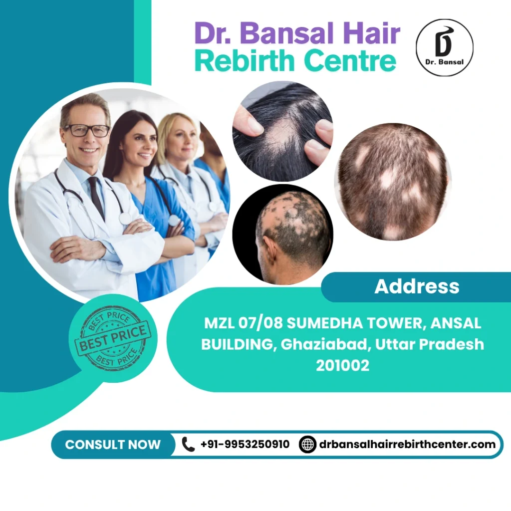 Best Doctor to See for Hair Loss