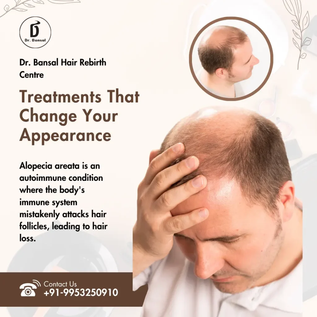 alopecia areata Hair Salution