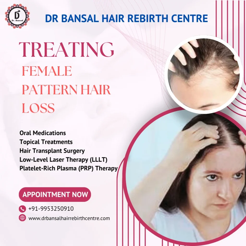 FPHL Hair Loss Treatment