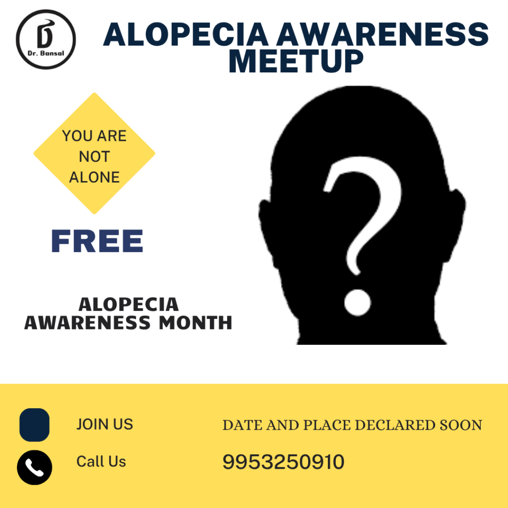 Free Alopecia Meetup