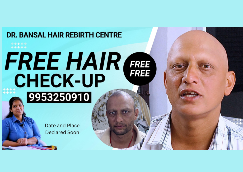 Free Alopecia Awareness Meetup