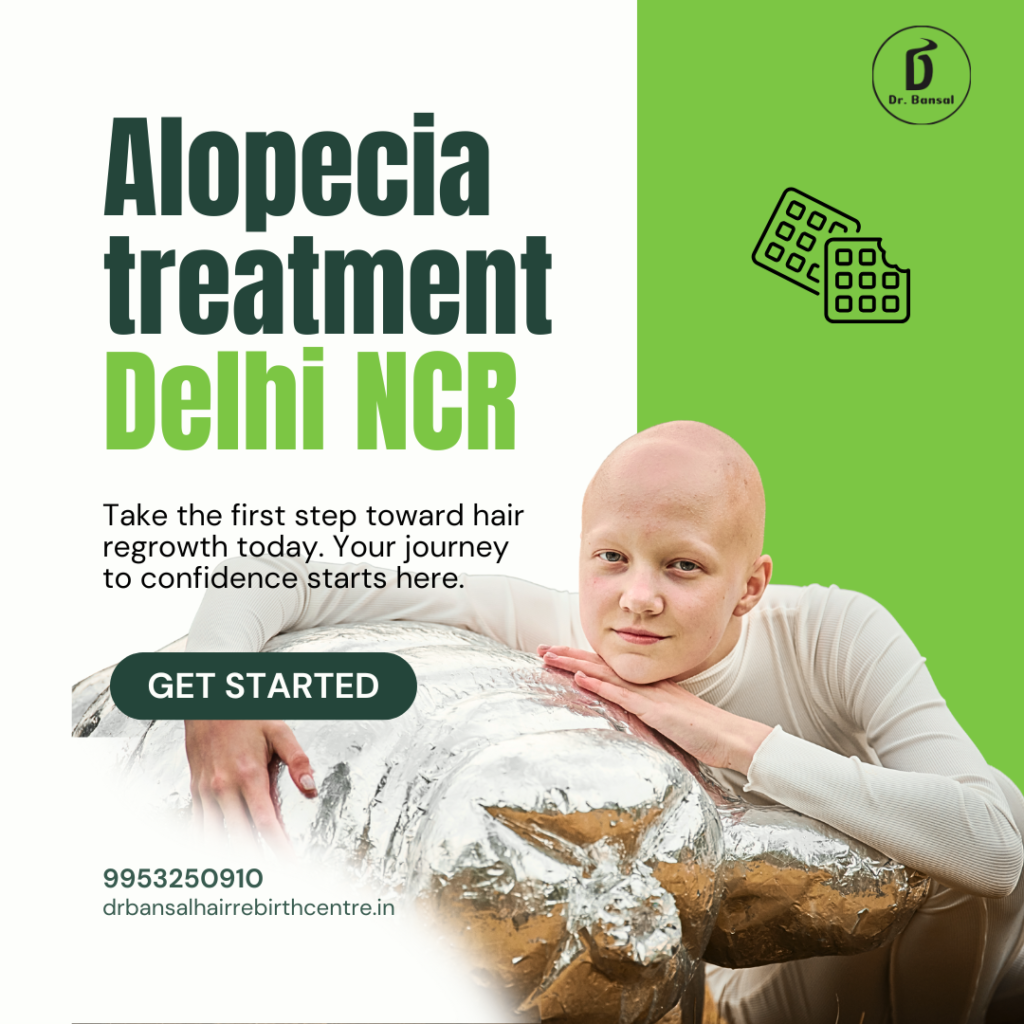 Alopecia Treatment Delhi NCR