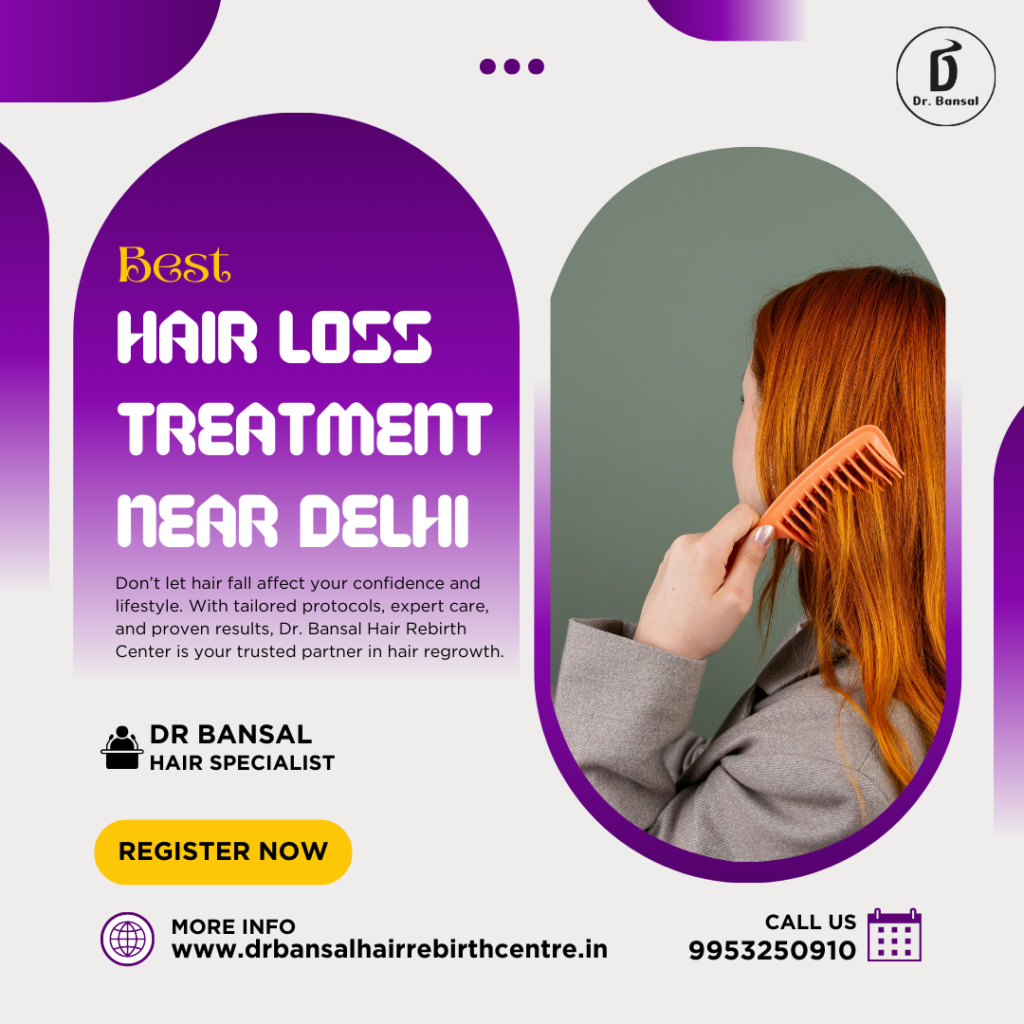 Best Hair Loss Treatment Near Delhi