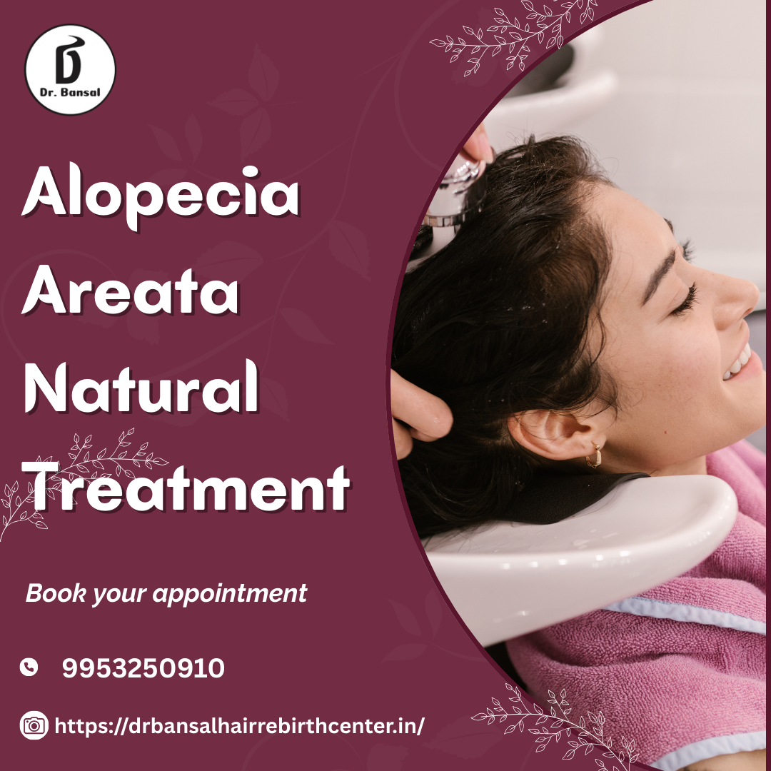 Alopecia Areata Natural Treatment -1