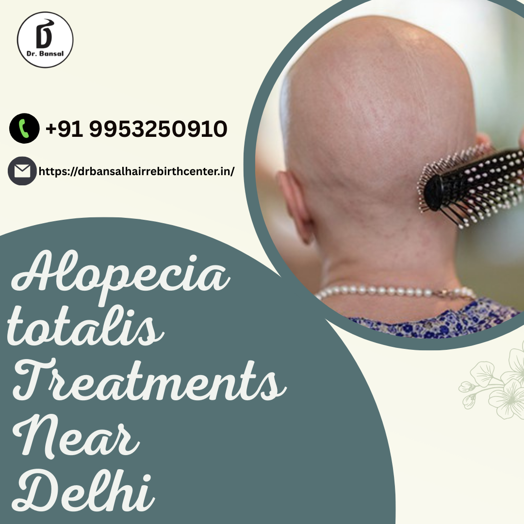 Alopecia totalis Treatments Near Delhi