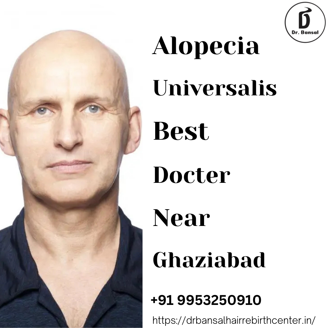 Alopecia Universalis Best Docter Near Ghaziabad