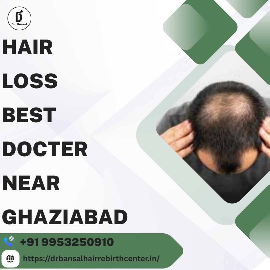 Hair Loss Best Docter Near Ghaziabad