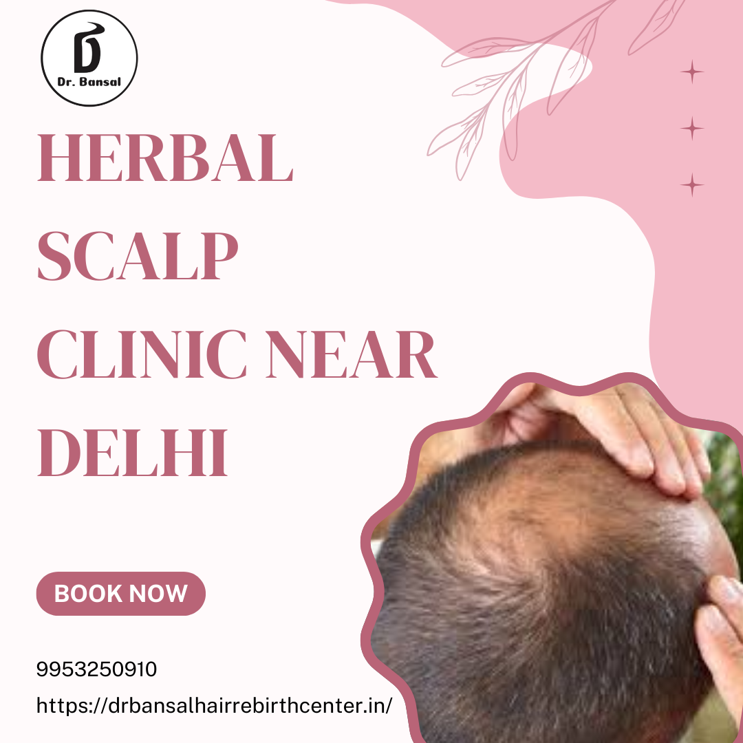 Herbal Scalp Clinic Near Delhi