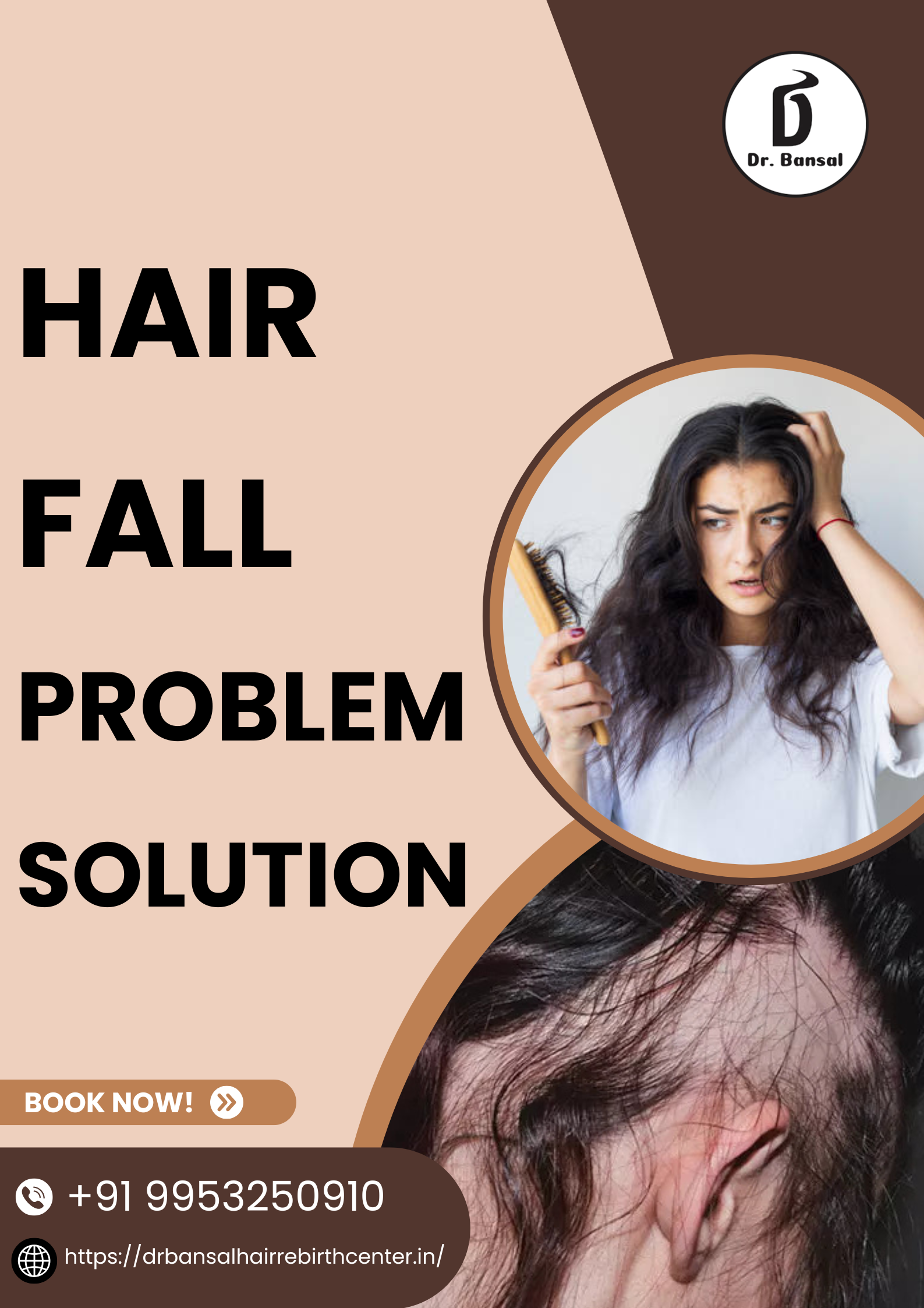 Hair Fall Problem Solution No 1