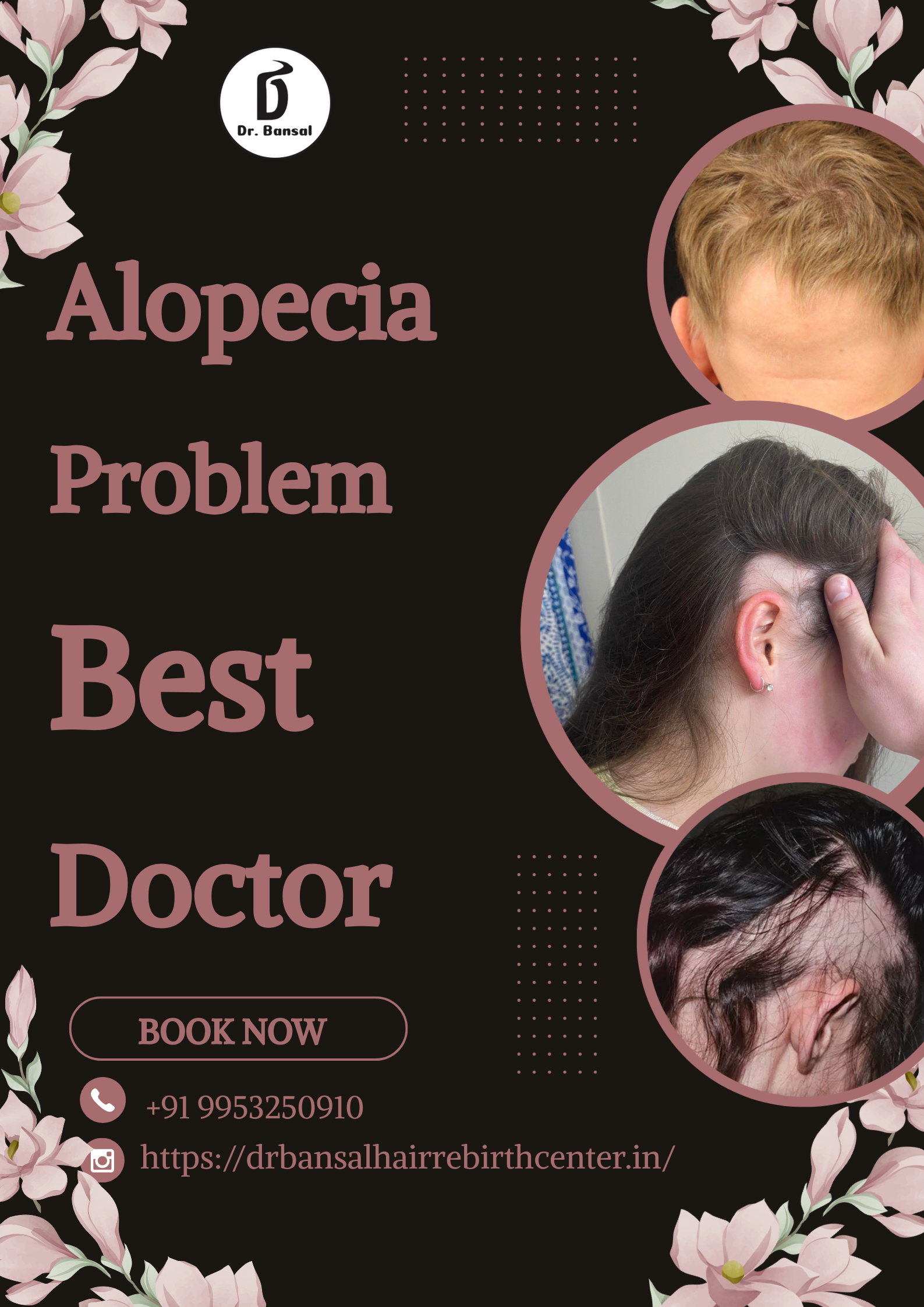 alopecia problem best doctor
