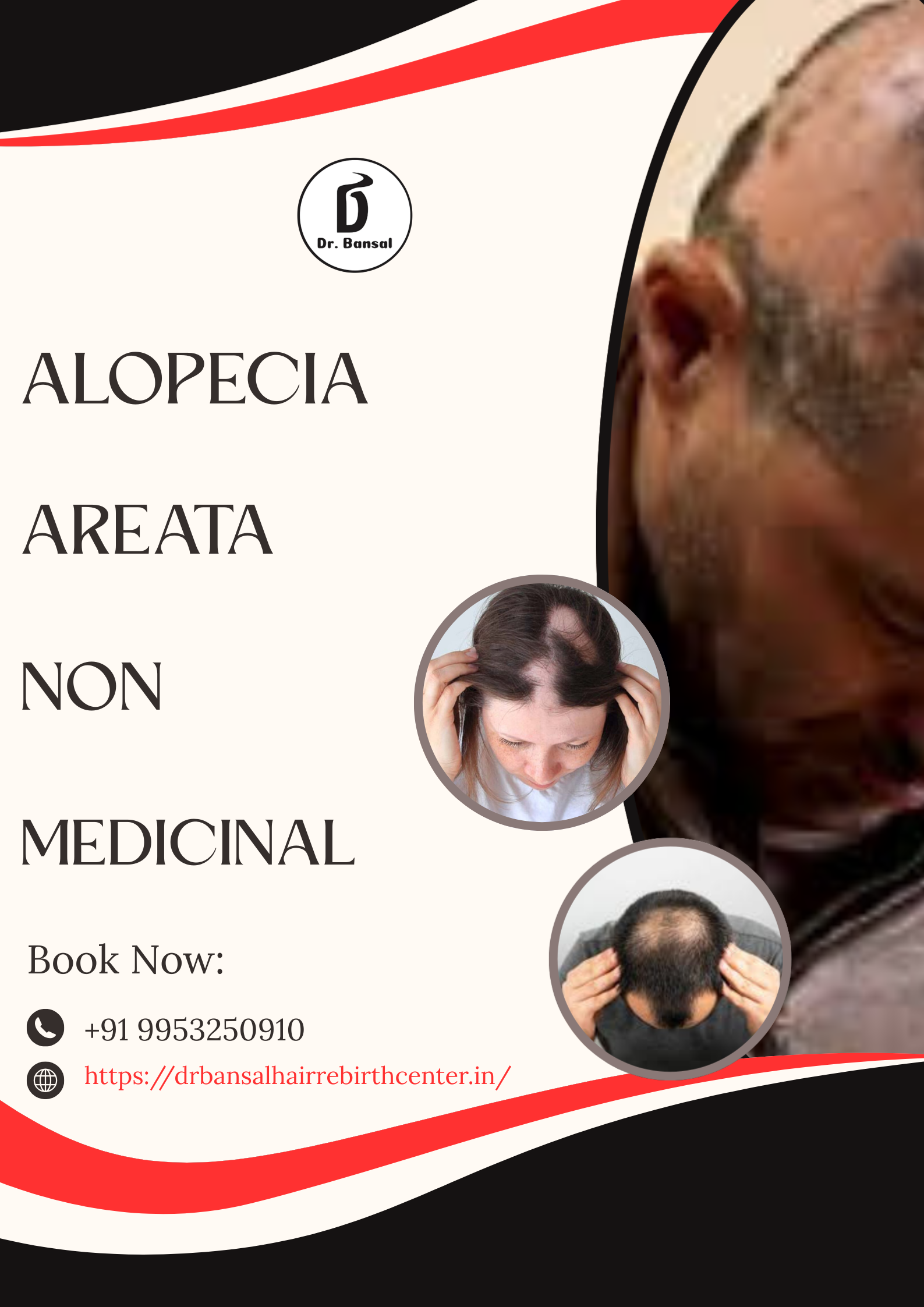 Alopecia Areata Non-Medicinal